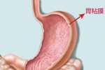 胃黏膜受损会有哪些表现？这几个症状很明显