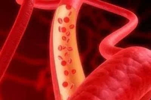 “血稠”，这个伪科学还要骗中国人多久！你还蒙在鼓里吗？ ... ... ...