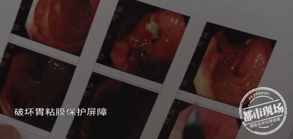 女子晚餐连吃3天月饼，半夜突然吐血！医生紧急提醒