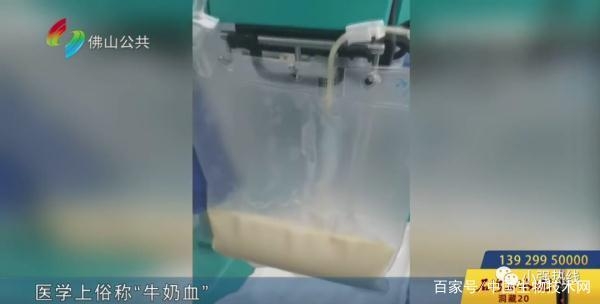 佛山24岁男子体内惊现“牛奶血”！医生：他吃外卖常点这几样！ ...