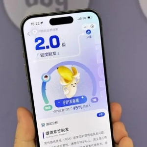 杭州程序员研发AI毛发检测工具 支付宝拍照就能自测脱发等级