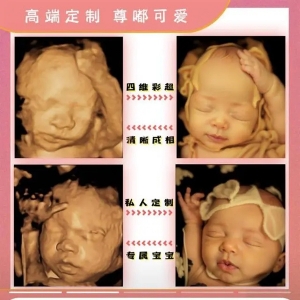 一张四维彩超图就能预测胎儿长相？专家：娱乐性大于准确性