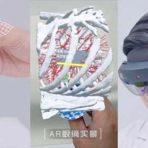 AR导航手术系统与国产诊断设备齐发力，浦东创新药械产品持续上新